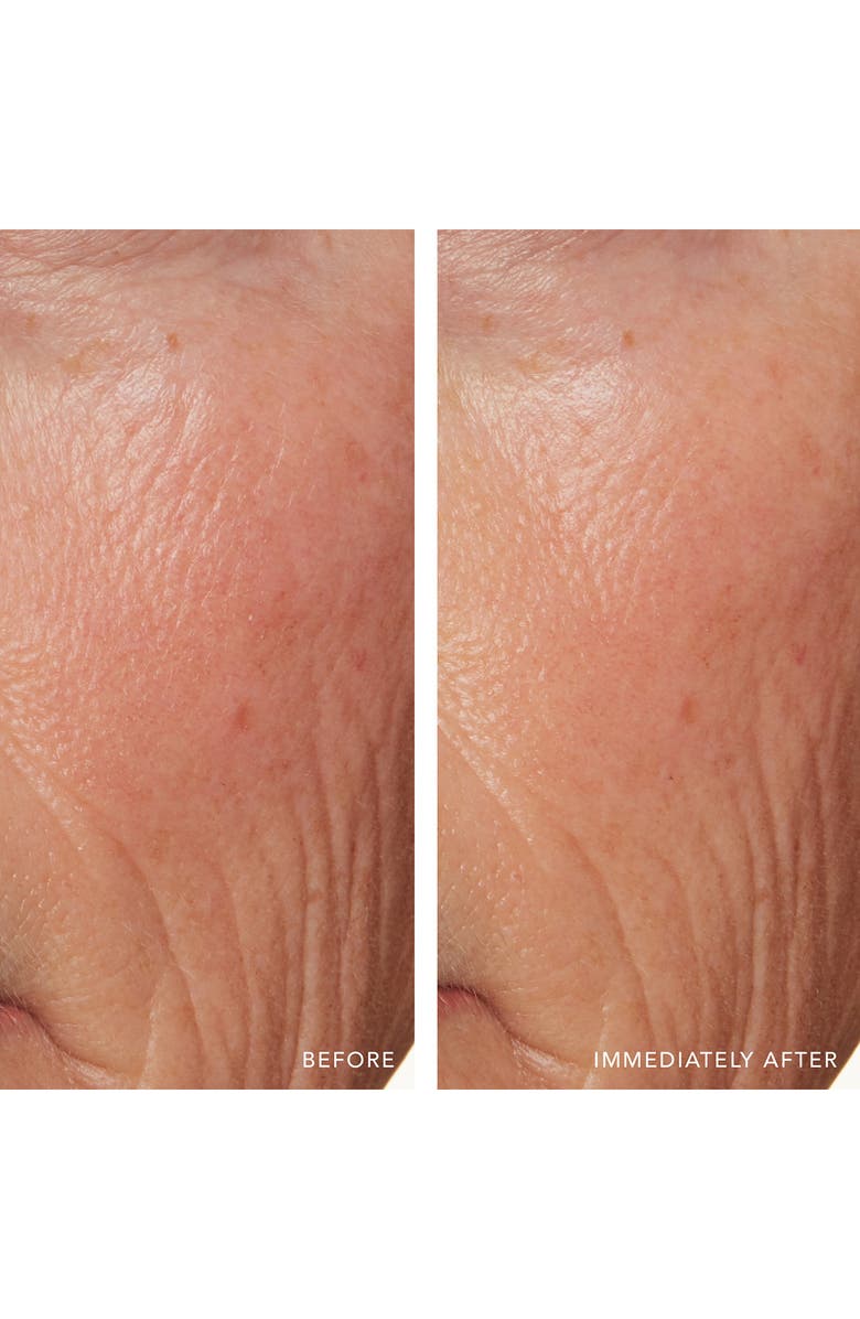 LANCER Skincare Redness Relief Intense with Manuka Honey, Alternate, color, 