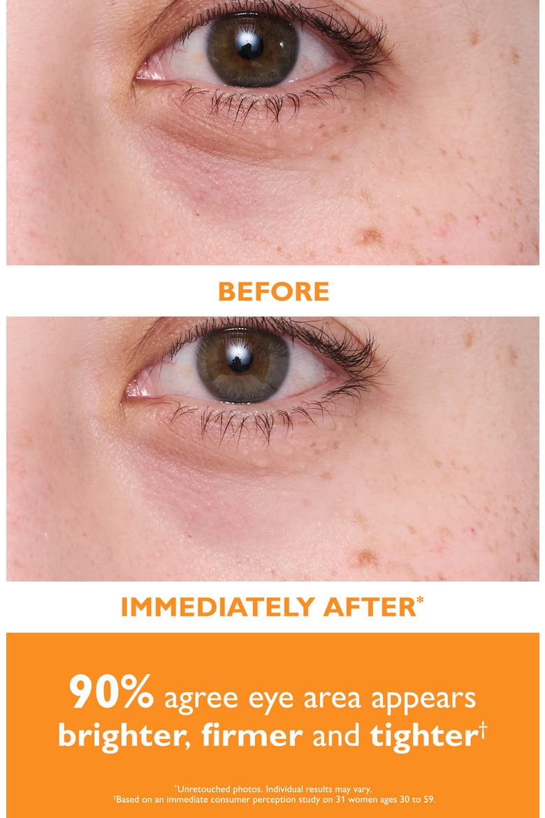 Potent-C™ Power Brightening Hydra-Gel Eye Patches, Alternate, color, NO COLOR