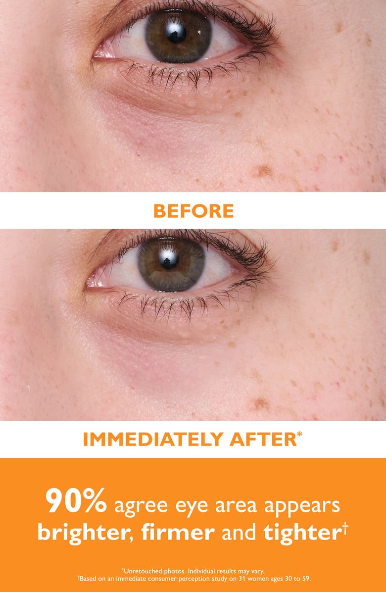 Peter Thomas Roth Potent-C<sup>™</sup> Power Brightening Hydra-Gel Eye Patches, Alternate, color,