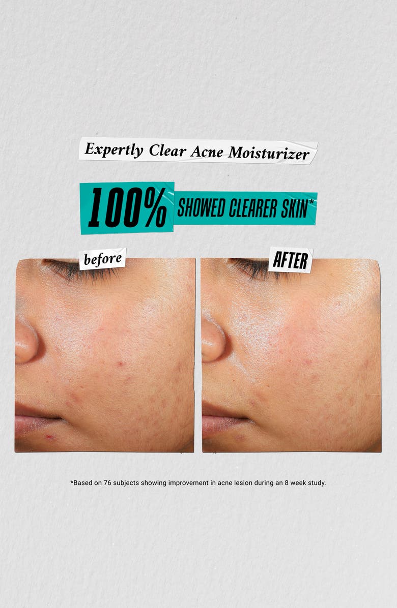 Kiehl's Since 1851 Skin Care Solutions Gift Set $87 Value, Alternate, color,