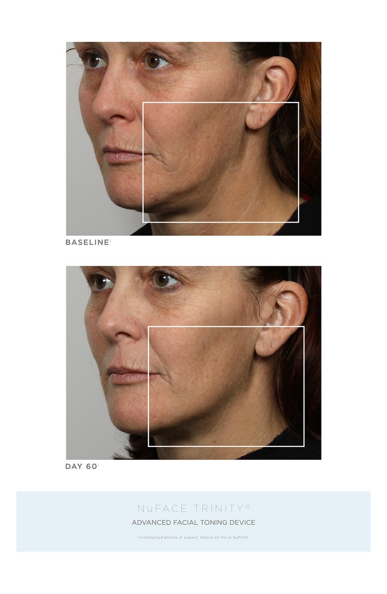 NuFACE<sup>®</sup> Refreshed Mini Kit - White, Alternate, color,
