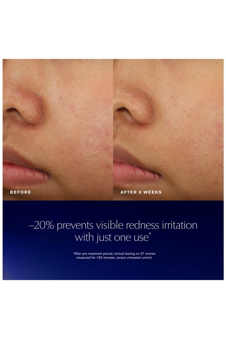 Advanced Night Repair Recovery Treatment Essence, Alternate, color, NO COLOR