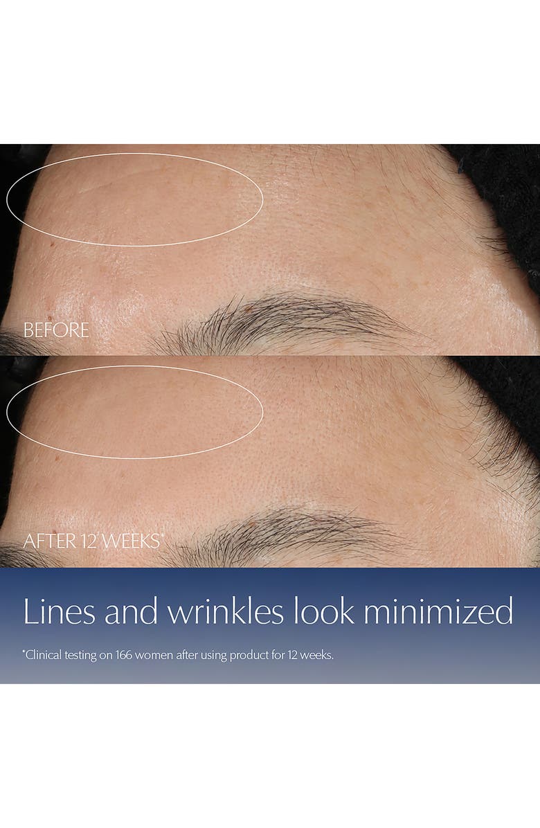 Estée Lauder Advanced Night Repair Synchronized Multi-Recovery Complex Serum Duo with Hyaluronic Acid & Peptides $250 Value, Alternate, color, 