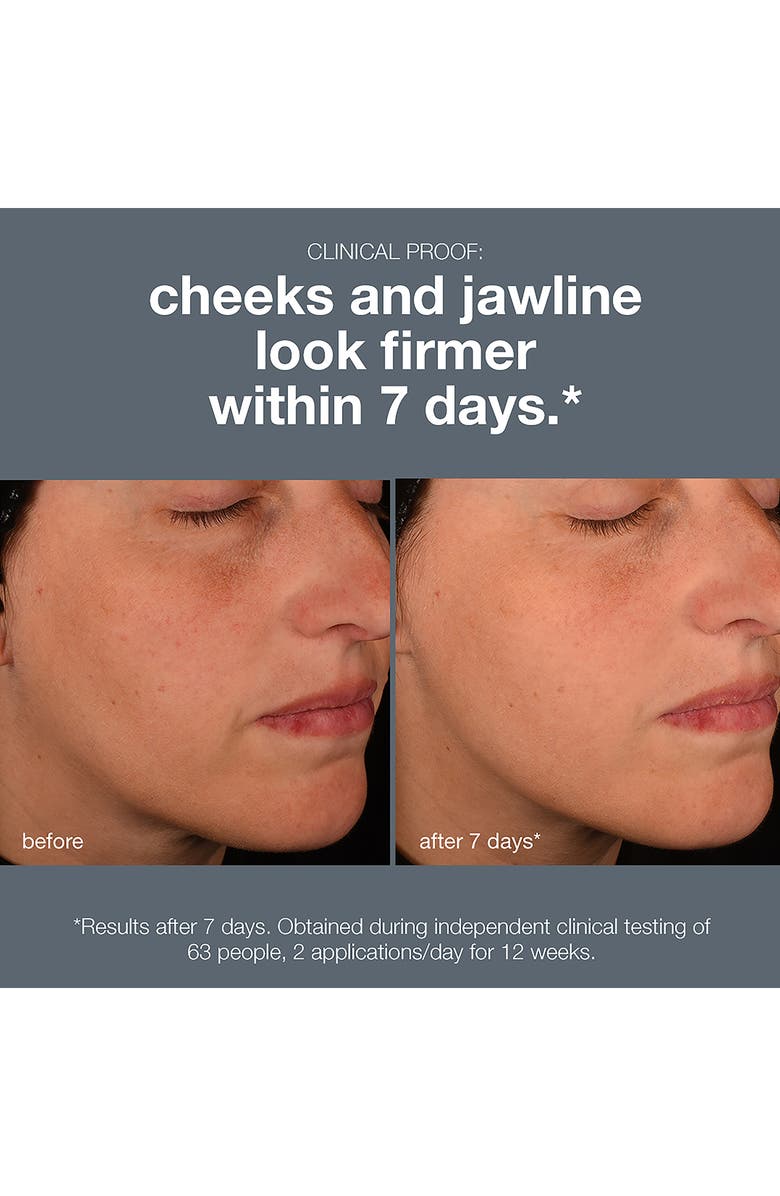 dermalogica<sup>®</sup> Pro-Collagen Banking Serum, Alternate, color, 