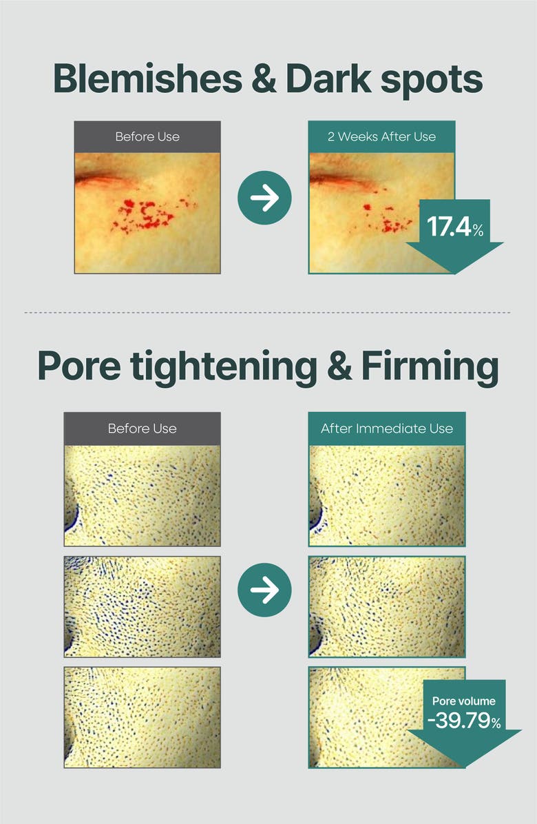 Equlib Eau Briller MelaVita Pore-Refining Gel Mask, Alternate, color, NO COLOR