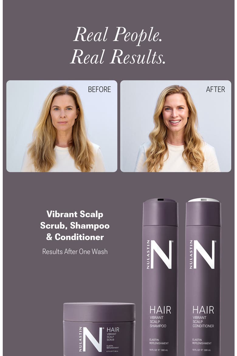 Vibrant Scalp System, Alternate, color, White Brilliant