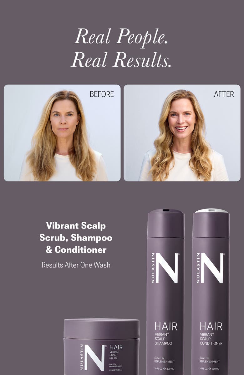 NULASTIN Vibrant Scalp System, Alternate, color, White Brilliant