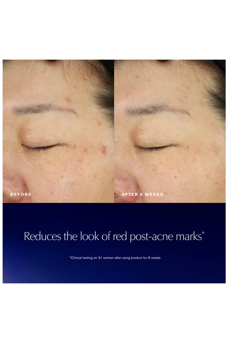 Advanced Night Repair Recovery Treatment Essence, Alternate, color, NO COLOR