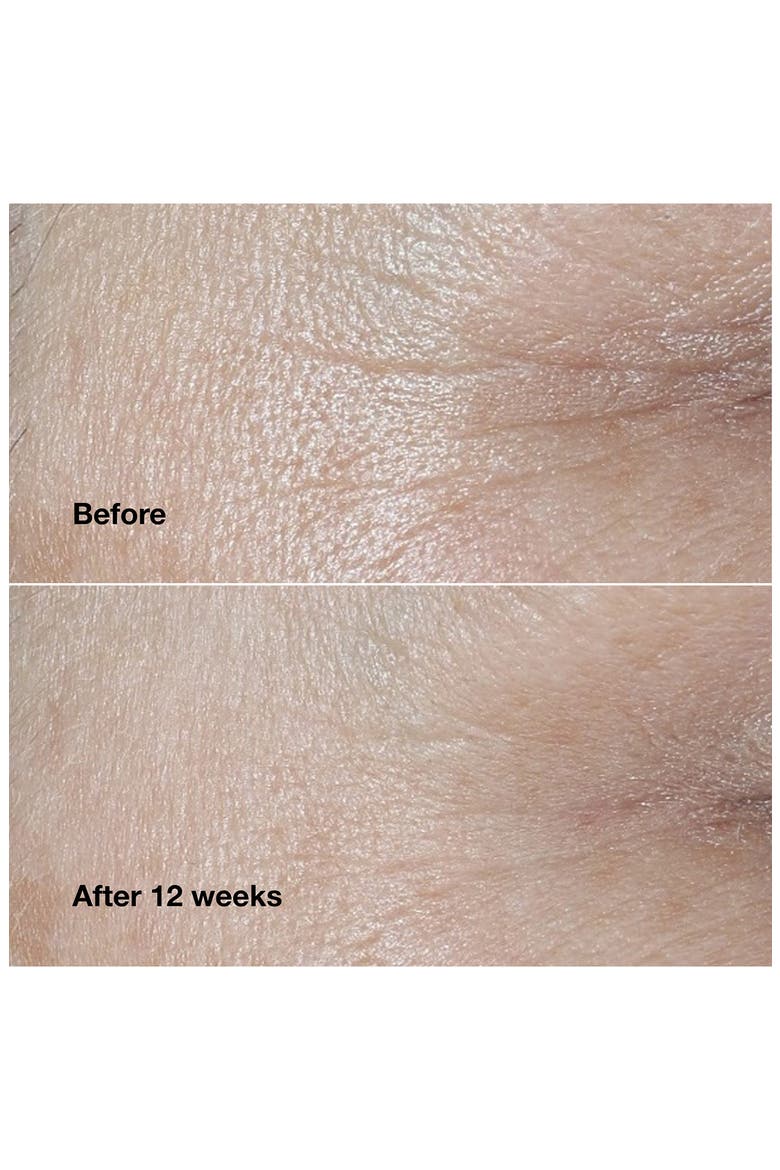 Smart Clinical Repair Wrinkle Correcting Face Cream, Alternate, color, NO COLOR