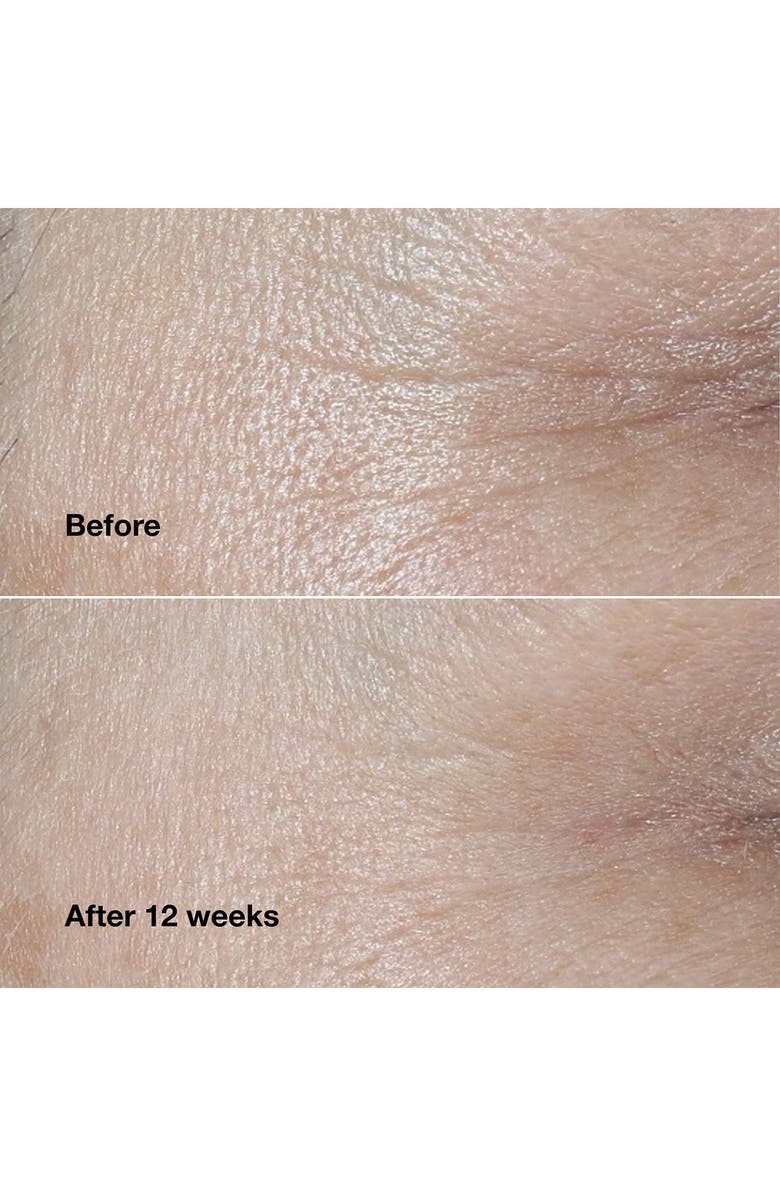 Clinique Smart Clinical Repair Wrinkle Correcting Face Cream, Alternate, color,