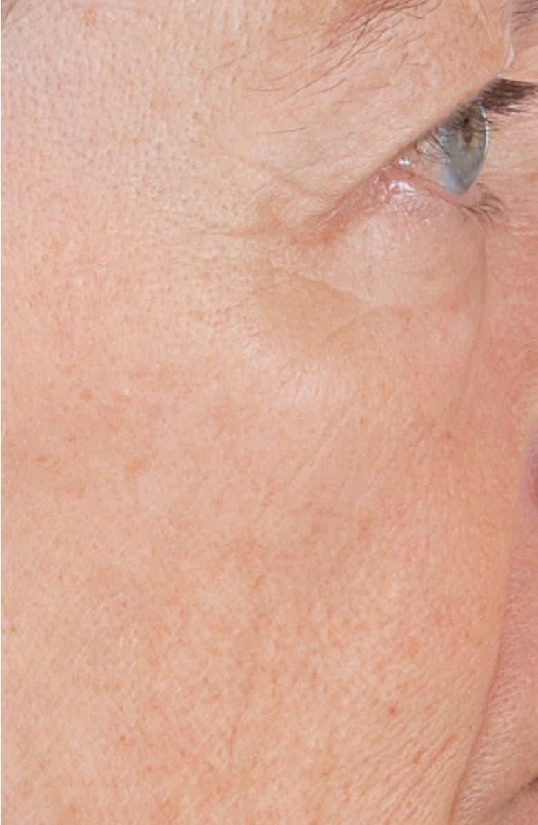 Perricone MD High Potency Hyaluronic Intensive Hydrating Serum, Alternate, color,