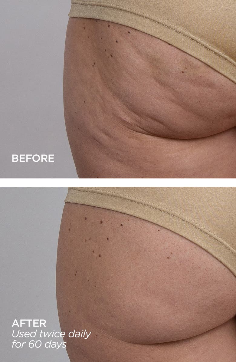 BeautyBio GloPRO<sup>®</sup> Microneedling Regeneration Head-to-Toe Glo Set, Alternate, color,