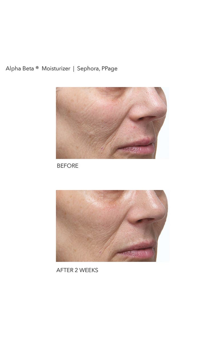 Dr. Dennis Gross Skincare Alpha Beta<sup>®</sup> Daily Moisturizer, Alternate, color,