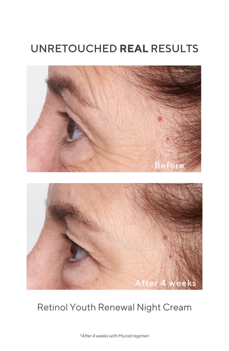 Murad<sup>®</sup> Retinol Youth Renewal Night Cream, Alternate, color,