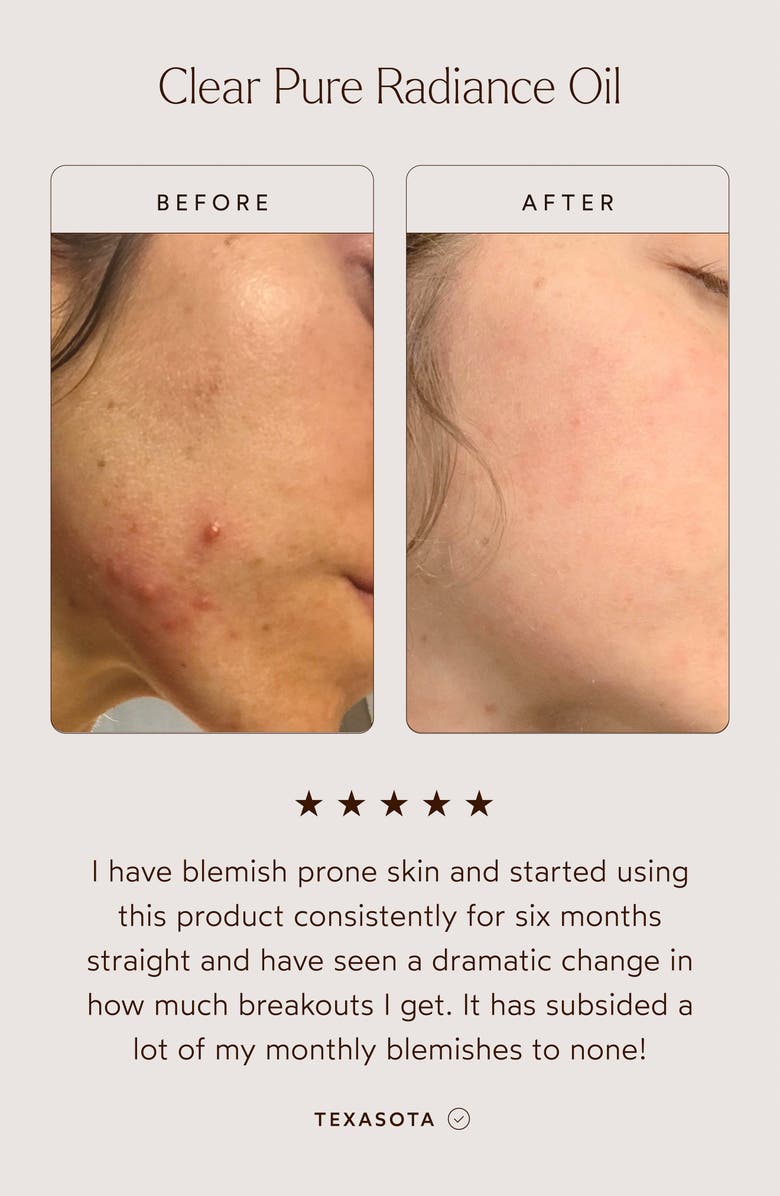 True Botanicals Clear Pure Radiance Oil, Alternate, color,