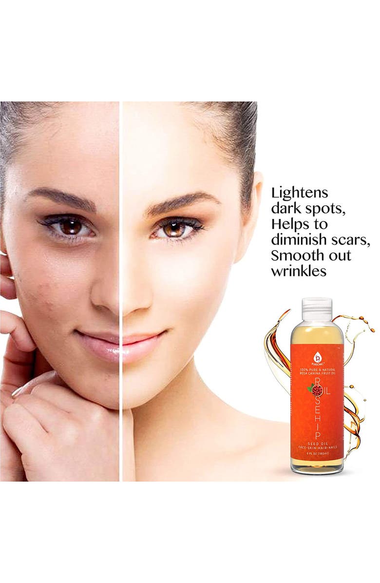 PURSONIC 100% Pure Rosehip Oil 6 Oz, Alternate, color, Multicolor