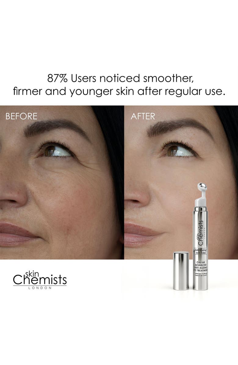 SKINCHEMISTS Caviar Advanced Anti-Ageing Eye Treatment 15ml for Loss of Firmness, Fine Lines & Wrinkles, Alternate, color, White