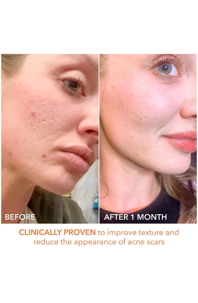 Dr. Dennis Gross Skincare Alpha Beta<sup>®</sup> Extra Strength Daily Peel - 60 Applications, Alternate, color,