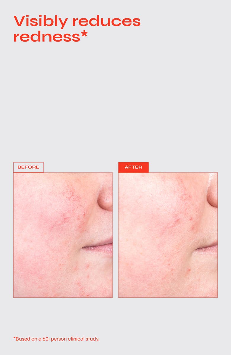 FACILE Destress Redness Calming Serum with Vitamin C & Ceramides, Alternate, color, 