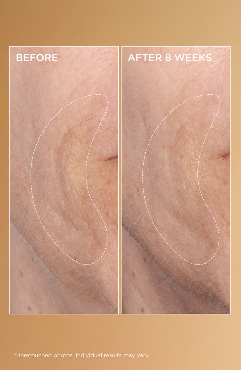 Perricone MD Neuropeptide Rejuvenating Moisturizer Broad Spectrum SPF 25, Alternate, color,