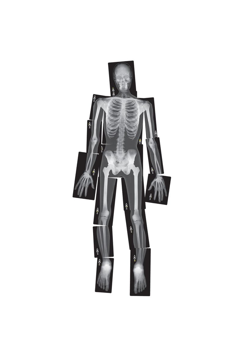 Human X-Rays on Film, Main, color, Multicolor