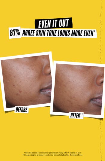 Better Screen UV Serum