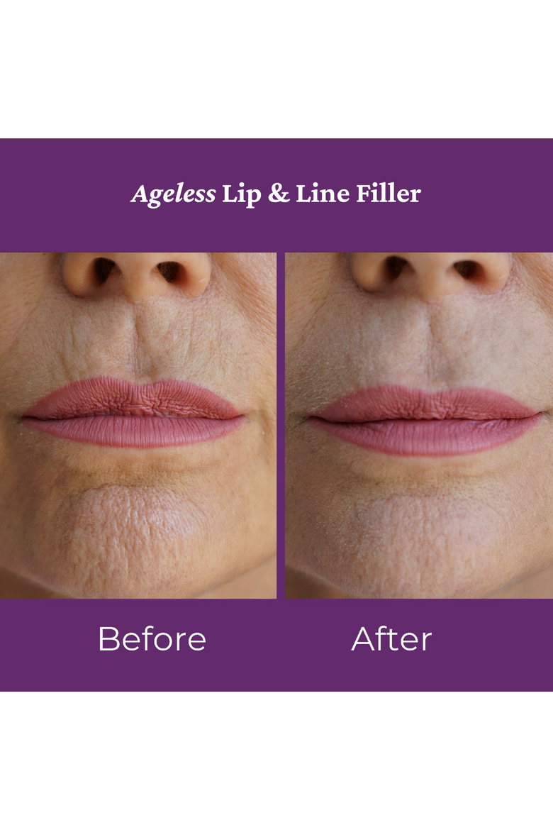 Ageless Lip Line Filler 8ml, Alternate, color, None