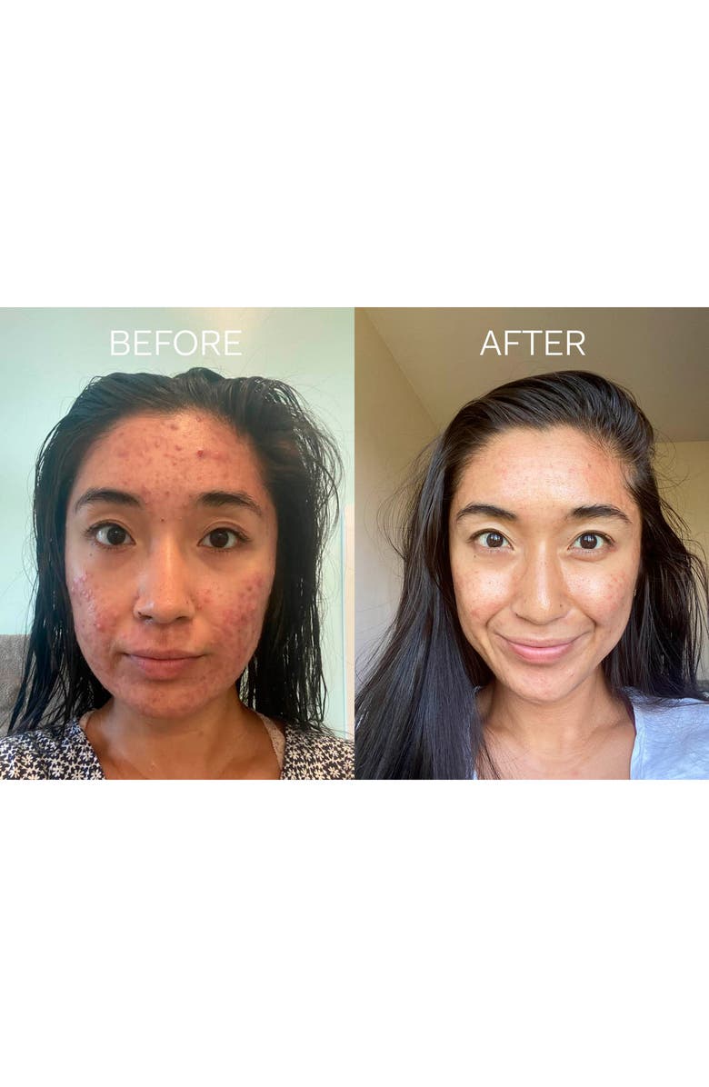 The Nue Co Skin Filter Dietary Supplement, Alternate, color, 