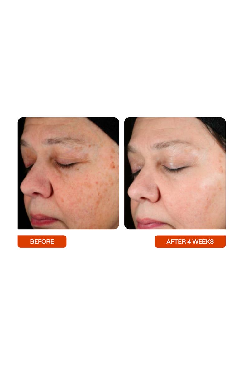 Universal Vitamin C Skin Refiner Serum, Alternate, color, NO COLOR