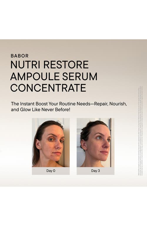 Babor X Solawave Skin Care & 2-in-1 Device Set (nordstrom Exclusive) $354 Value In Transparent