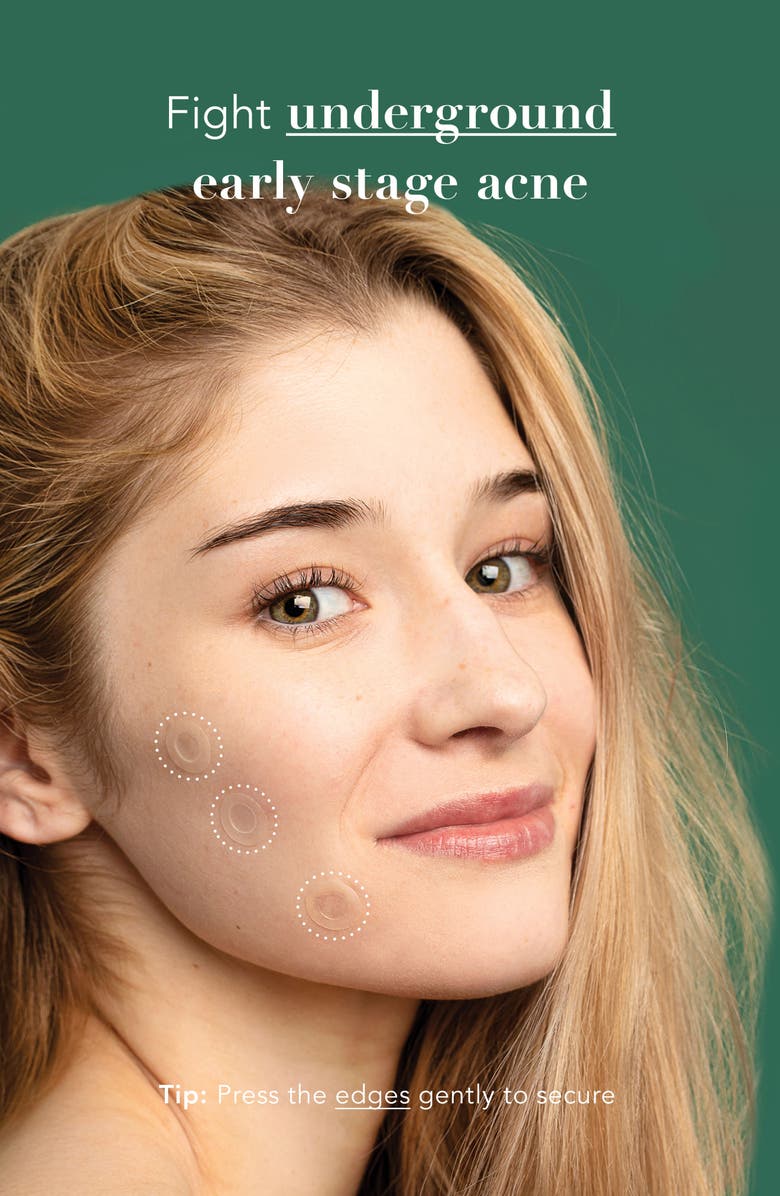 Rael Miracle Patch Microcrystal Acne Spot Cover Patches, Alternate, color, 