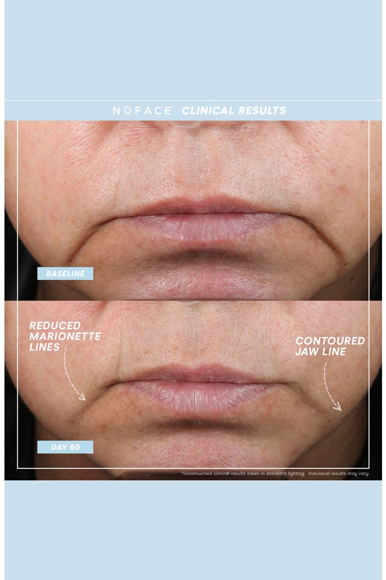 TRINITY+ Supercharged Skin Care Routine Set (Limited Edition) USD $509 Value, Alternate, color, NO COLOR
