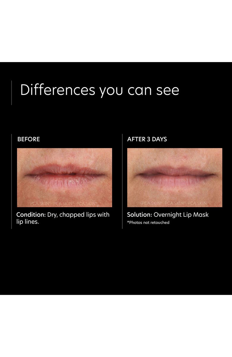 PCA Skin Overnight Lip Mask, Alternate, color, 