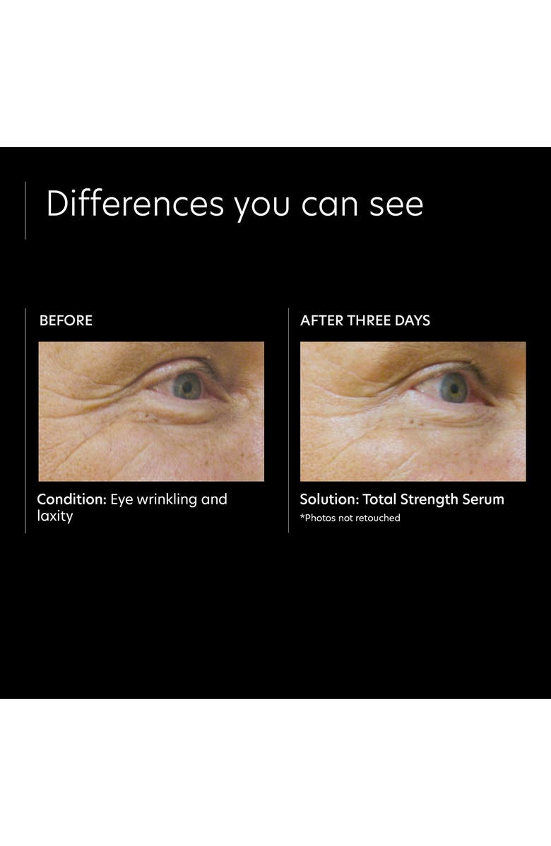 PCA Skin Total Strength Serum, Alternate, color,