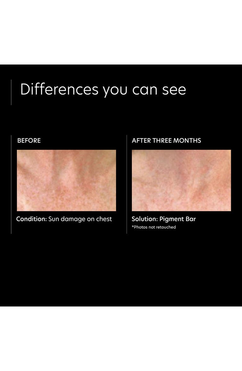 PCA Skin Pigment Bar, Alternate, color,