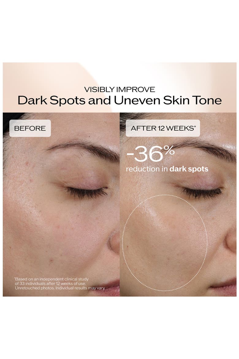 Benefiance Dark Spot & Wrinkle Serum, Alternate, color, NO COLOR
