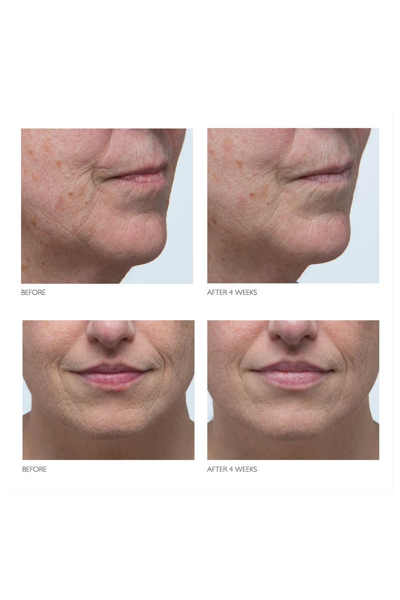 RetAsphere™ Micro Peel Retinol Glycolic Treatment, Alternate, color, NO COLOR