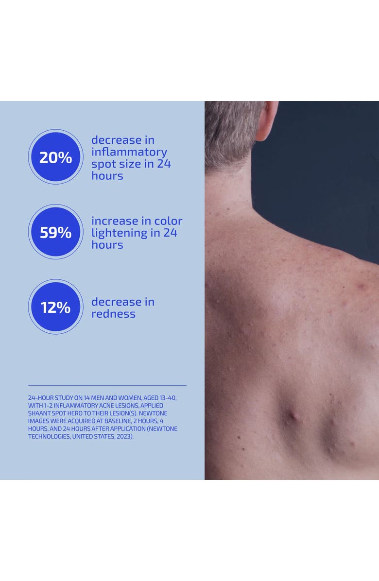 Codex Labs SHAANT Spot Hero, Alternate, color, Tan