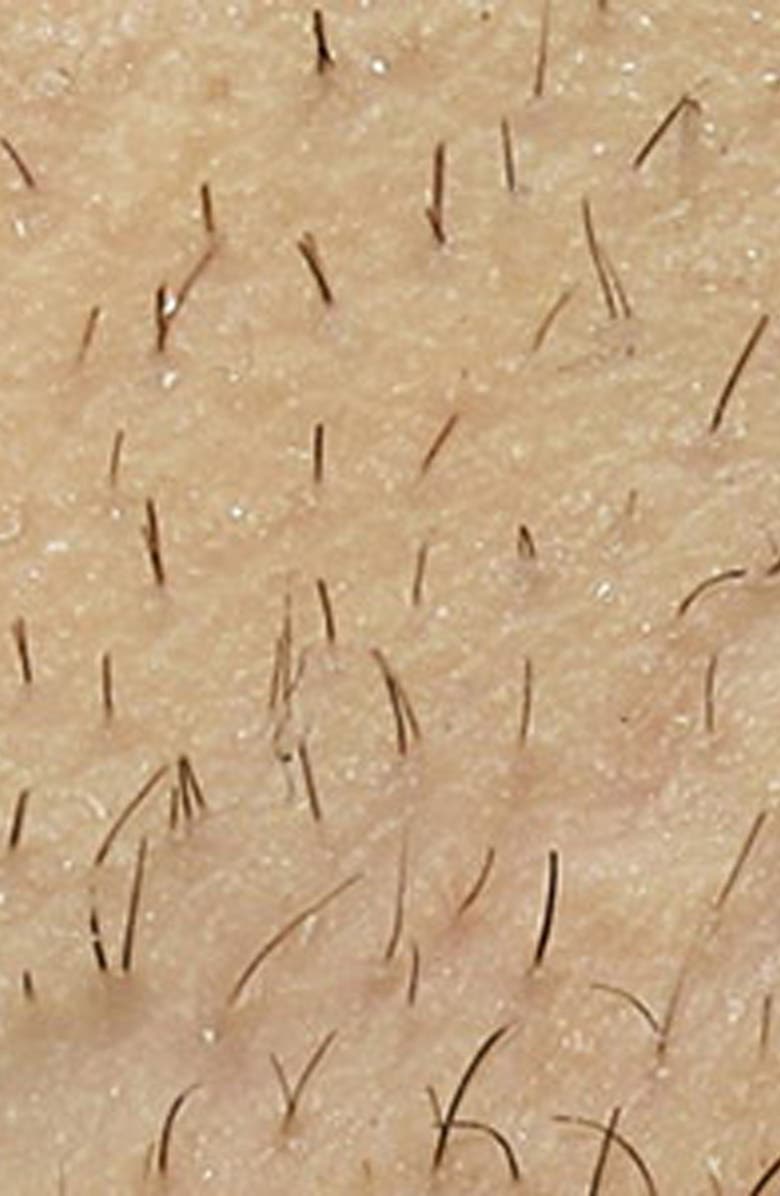 me Sleek Permanent Hair Reduction Device with Unlimited Treatments, Alternate, color,