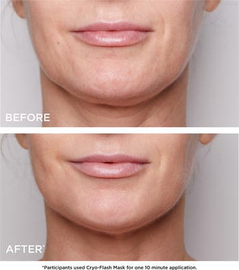 Cryo-Flash Instant Lift Effect & Glow Boosting Face Mask