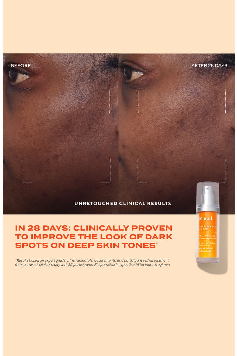 Rapid Dark Spot Correcting Serum, Alternate, color, NO COLOR
