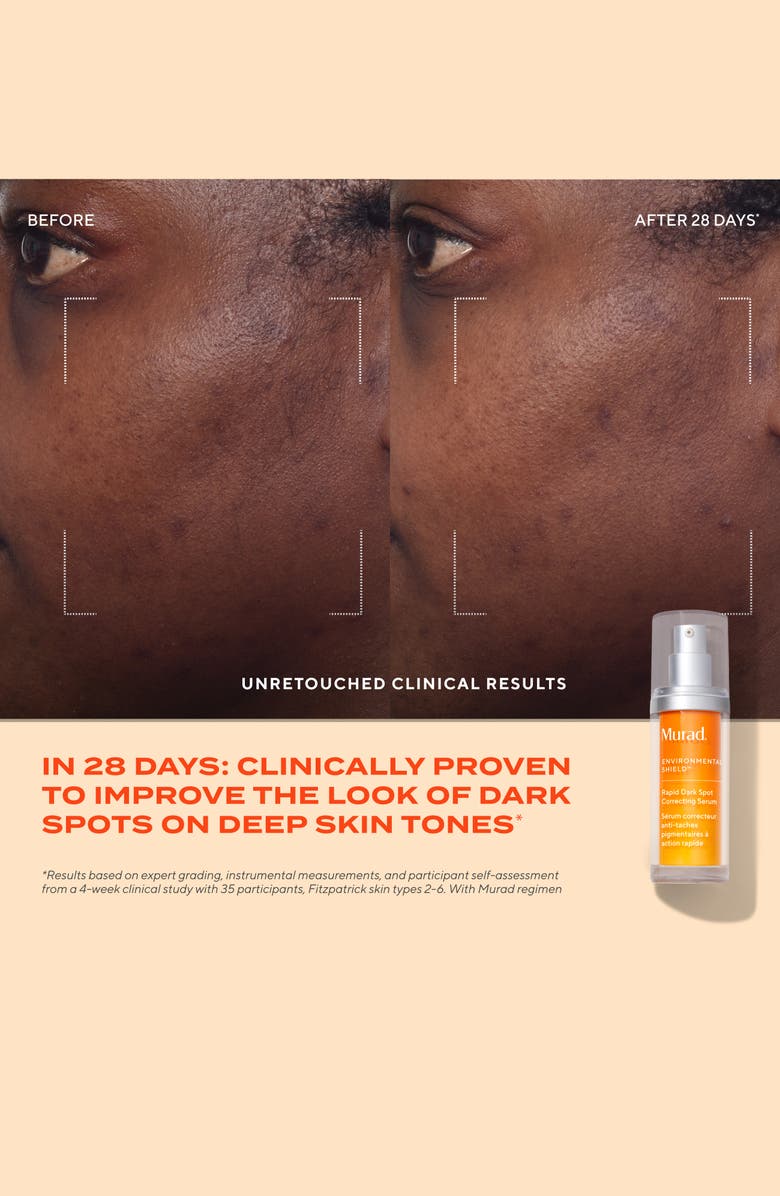 Murad<sup>®</sup> Rapid Dark Spot Correcting Serum, Alternate, color, 