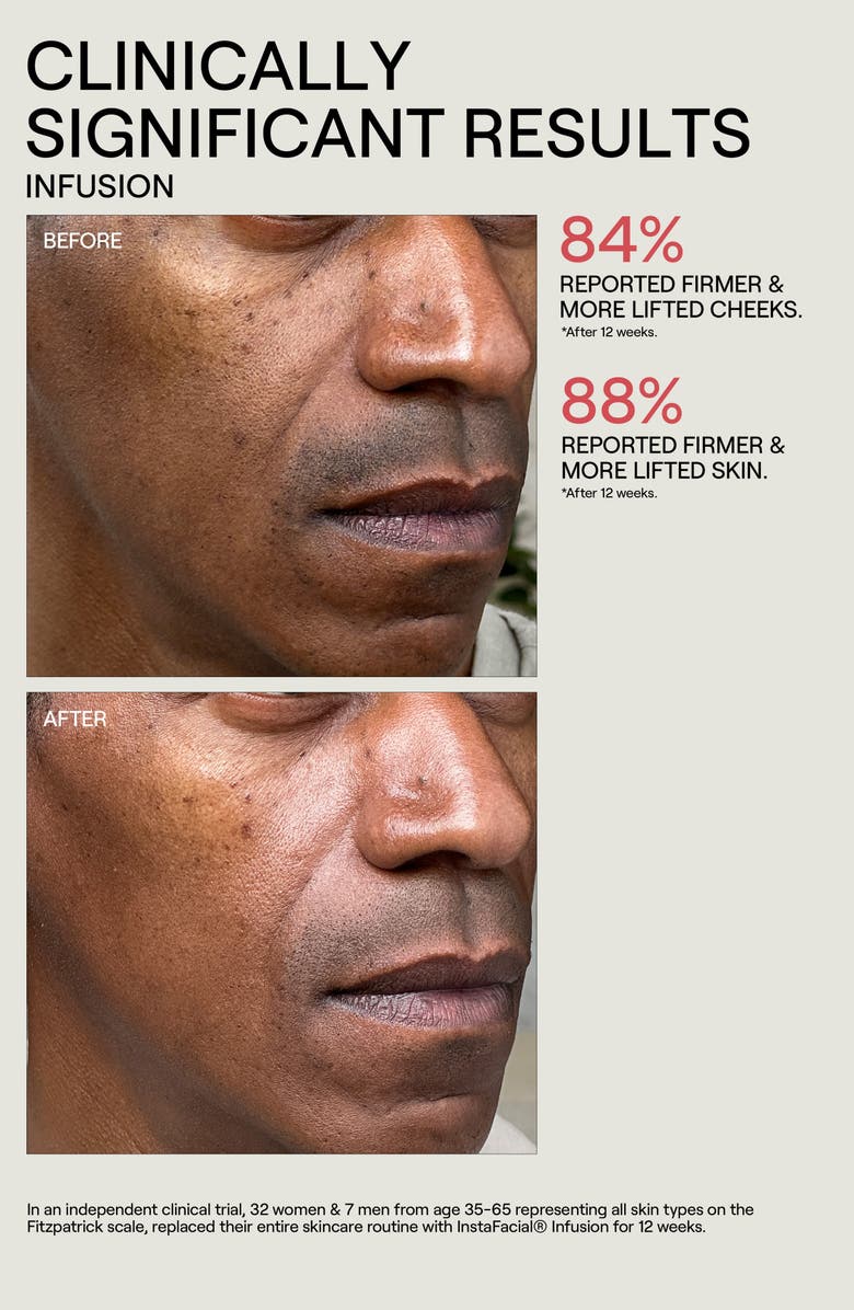 Dr. Diamond's Metacine Instafacial<sup>®</sup> Collection Trio Set, Alternate, color, 