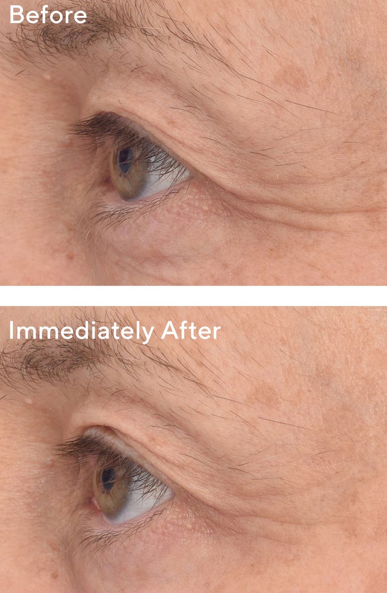 Murad<sup>®</sup> Dr. Zion Resurgence<sup>™</sup> Retinol Youth Renewal Eye Masks, Alternate, color,