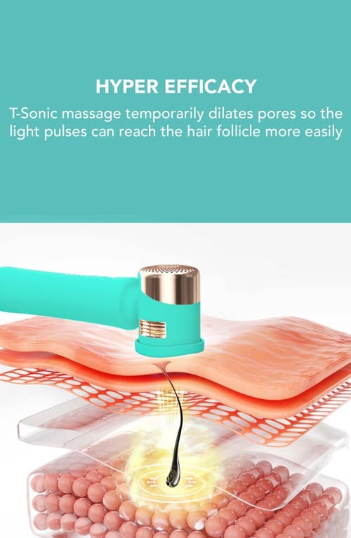 Foreo Peach™ 2 Ipl Hair Removal Device & Prep Gel Bundle In Green