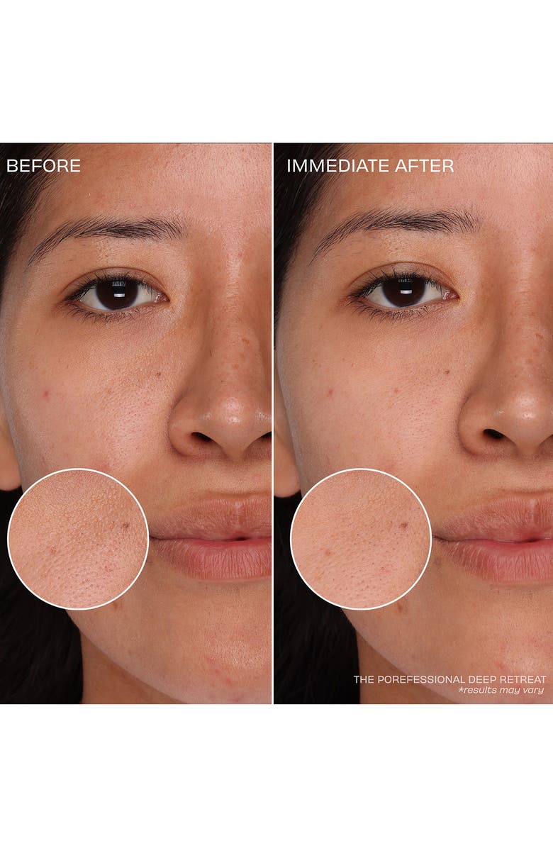 Benefit Cosmetics The Clear Necessities Set $53 Value, Alternate, color, 