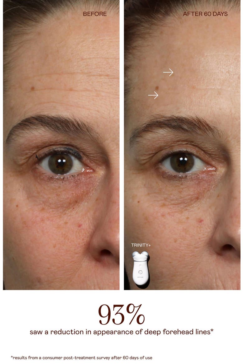 TRINITY+ Microcurrent Facial Toning Device with LED Red Light Attachment, Alternate, color, NO COLOR