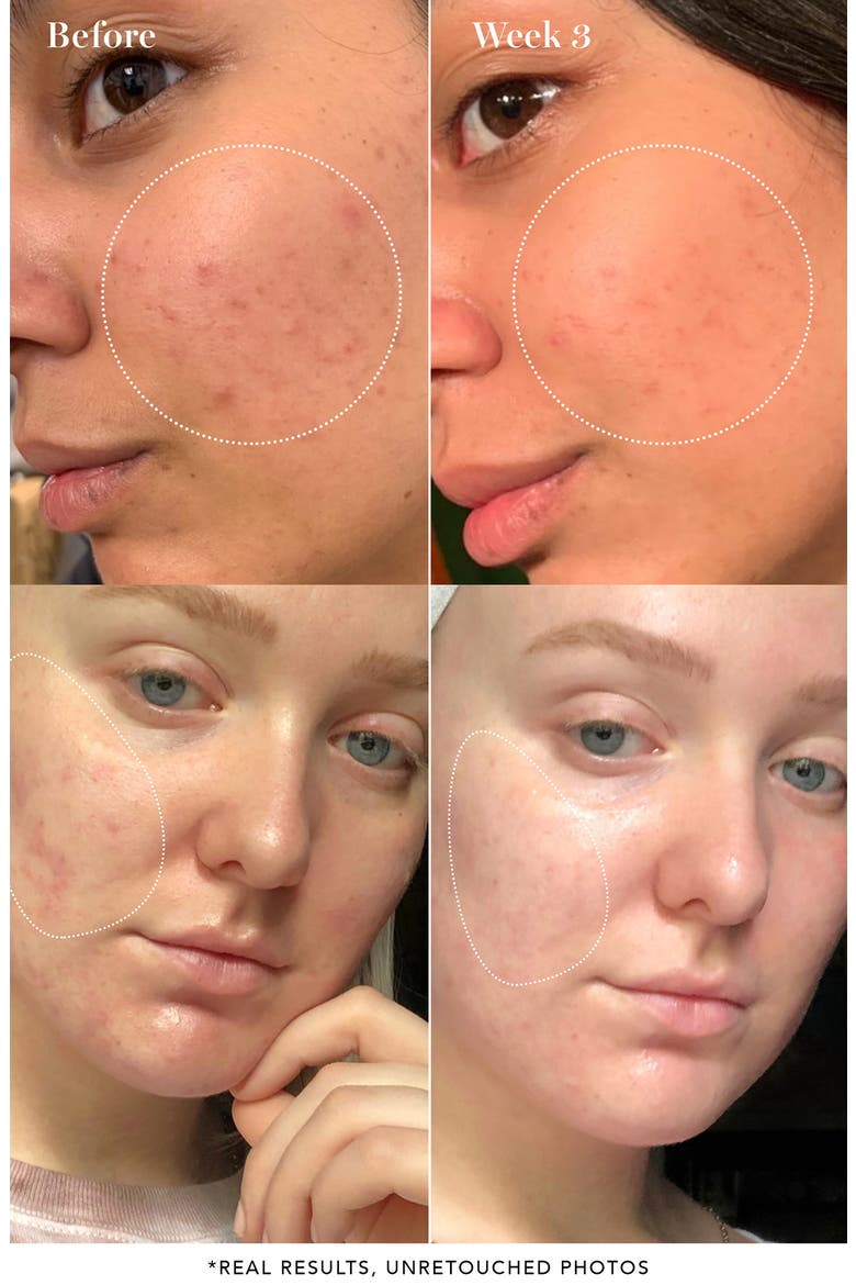 Pore Clarifying Toner, Alternate, color, NO COLOR