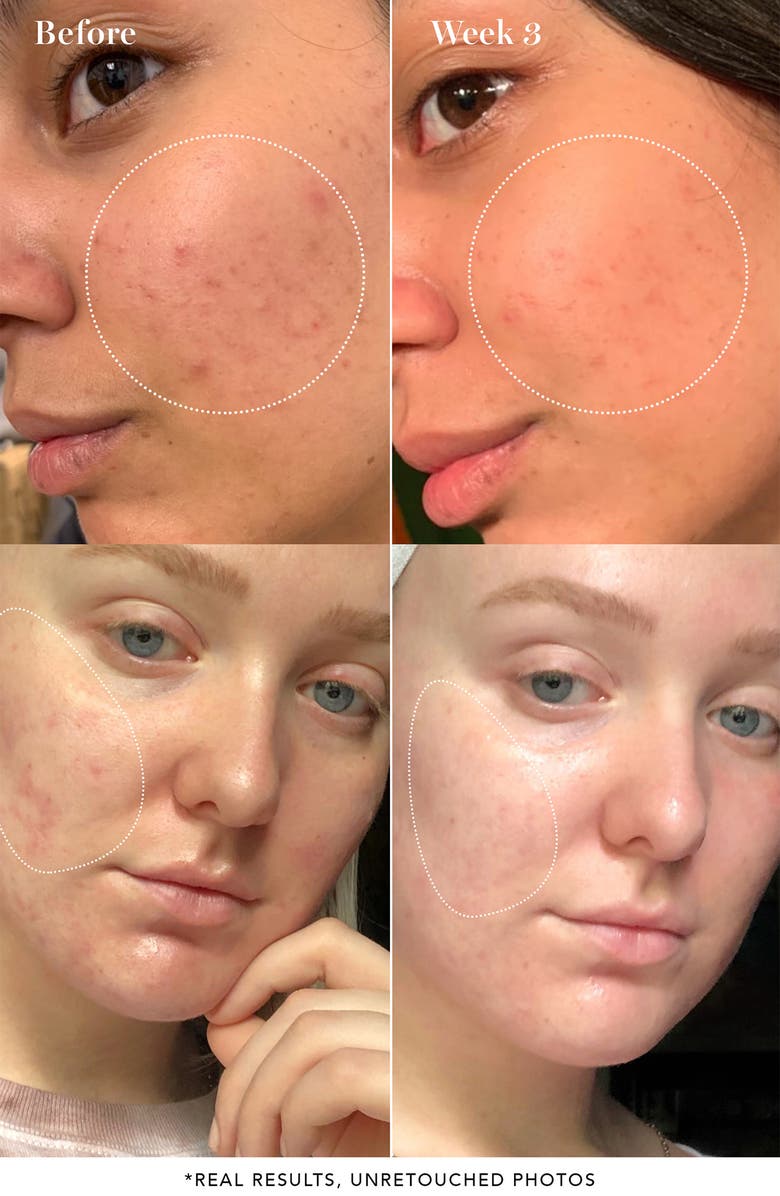 Saturday Skin Pore Clarifying Toner, Alternate, color, 