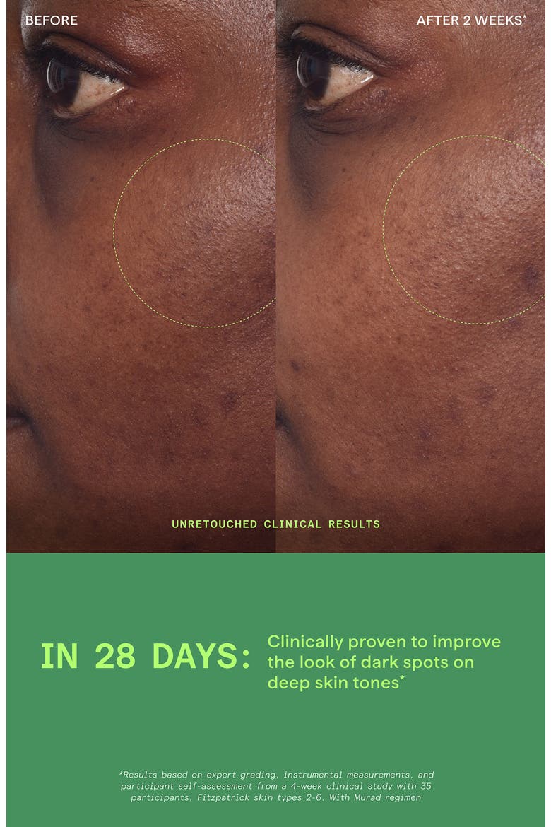 Rapid Dark Spot Correcting Serum, Alternate, color, NO COLOR